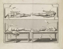 Giovanni Aldini. Essai théorique et expérimental sur le galvanisme Theoretical and experimental essay on galvanism Paris, 1804.