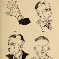 Drawings of various types of head-bandages.
